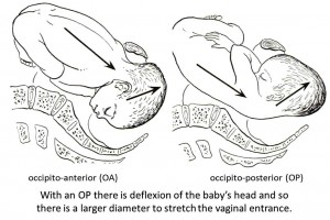 Baby Head Positions in Delivery
