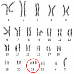 Nuchal Translucency Scan - Chromosomes