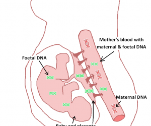 The Non-Invasive Prenatal Test (NIPT) post updated