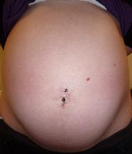 Belly Ring in Pregnancy