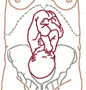 Right Head Position for Baby