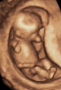 Ultrasound of Baby