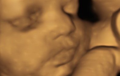 Ultrasound scans in pregnancy