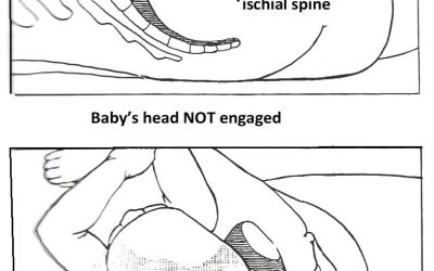 Baby’s head did not engage until in 2nd stage labour